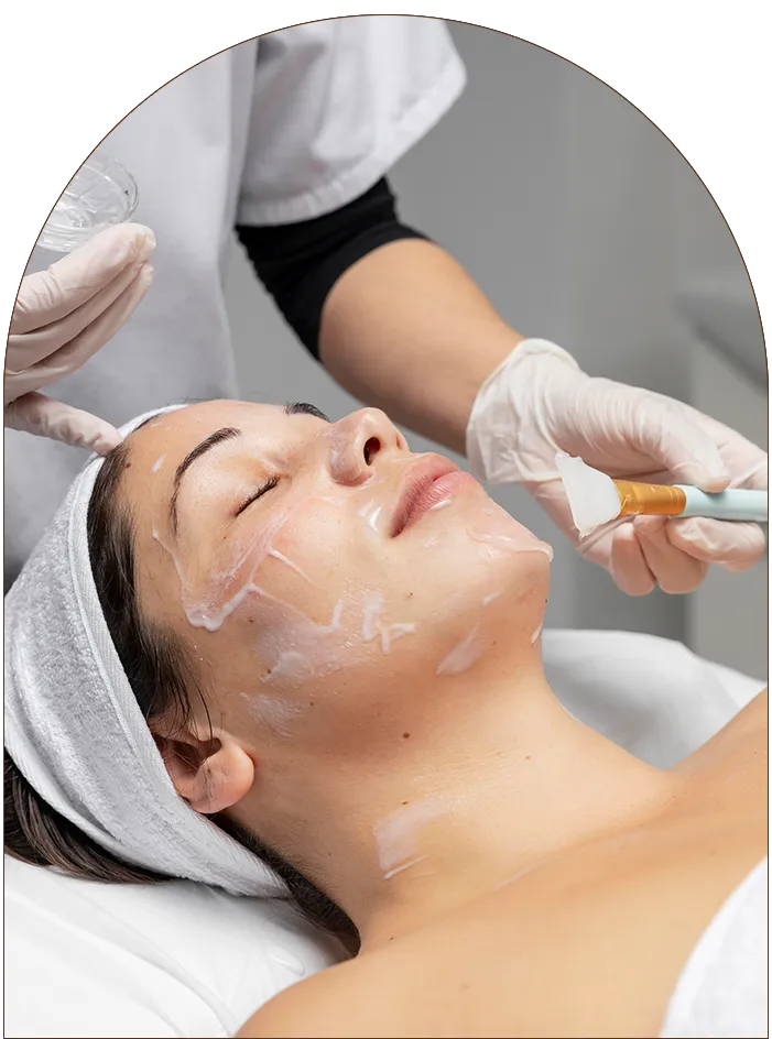 Chemical peel treatment at House of Aetheria, Gurgaon